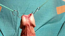 Opening urethra